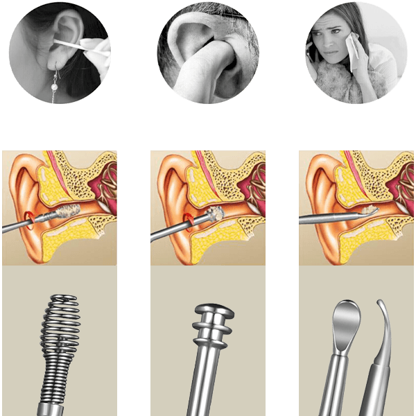 Zestaw do czyszczenia uszu 03